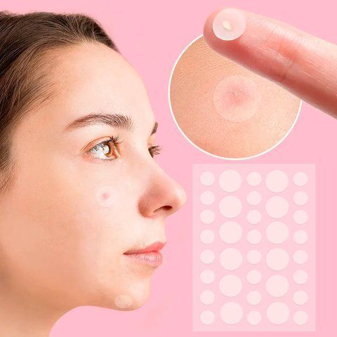 Пластир від прищів та акне 72шт Acne Patch / Косметичні патчі від бородавок та папілом / Пластирі наклейки 0234574162 фото
