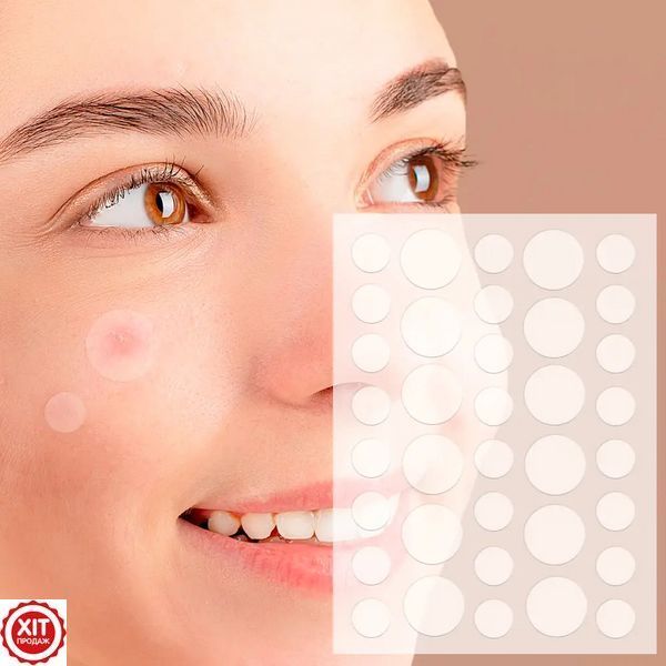 Пластир від прищів та акне 72шт Acne Patch / Косметичні патчі від бородавок та папілом / Пластирі наклейки 0234574162 фото