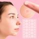 Пластир від прищів та акне 72шт Acne Patch / Косметичні патчі від бородавок та папілом / Пластирі наклейки 0234574162 фото 1